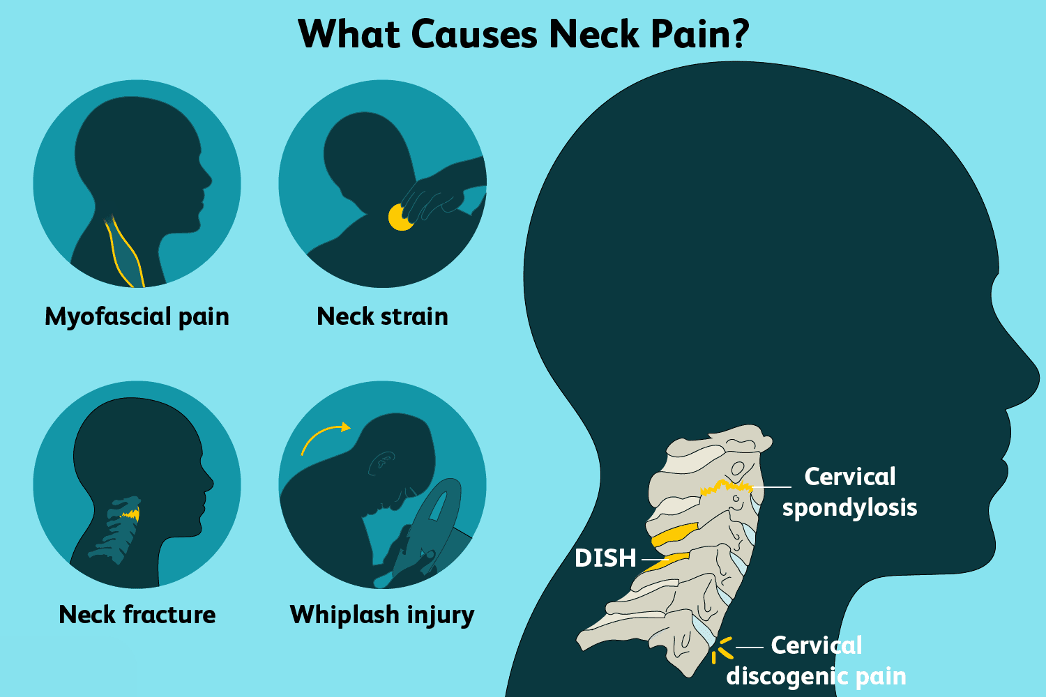 Neck Pain: 6 Common Causes and Treatments